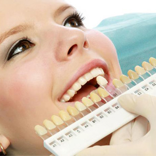 Chất lượng của răng sứ kim loại thường