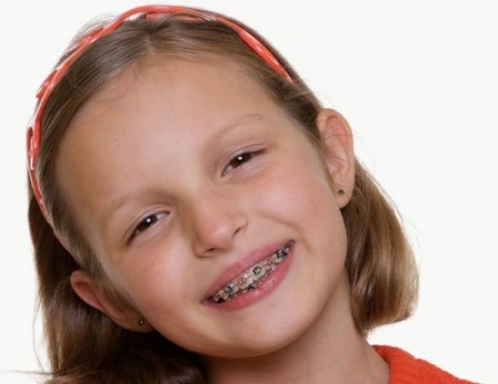 Chế độ chăm sóc cho trẻ em sau khi niềng răng