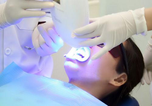 Những cách làm trắng răng tại nha khoa hiện nay 2