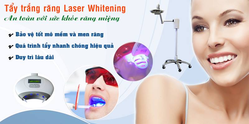 Phương pháp tẩy trắng răng bằng laser whitening như thế nào? 2