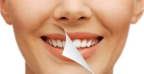 5 lý do bạn nên tìm hiểu sau tẩy trắng răng kiêng ăn gì 1