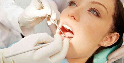 Giải đáp thắc mắc - Nên bọc răng sứ hay cấy ghép implant? 3