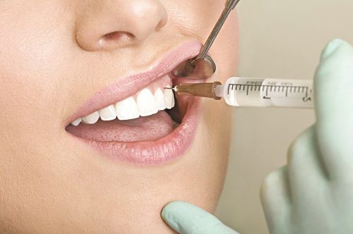 Răng khôn hàm trên mọc lệch phải làm sao? 3