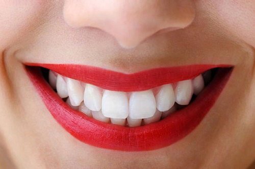 Nụ cười xinh nhờ bọc răng sứ cho răng bị thưa-2
