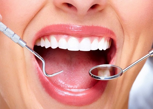 Bọc răng sứ titan có bị đen không? Cách xử lý viền nướu không bị đen-3
