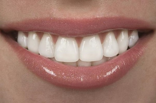 Bọc răng sứ chỉnh hô xương hàm tăng tính thẩm mỹ cho khuôn mặt-2