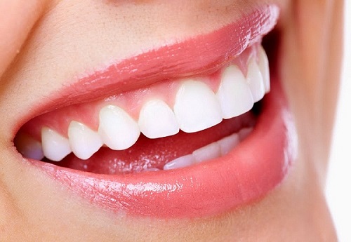 Bọc răng sứ titan có tốt không? 3 ưu điểm để chứng minh-4