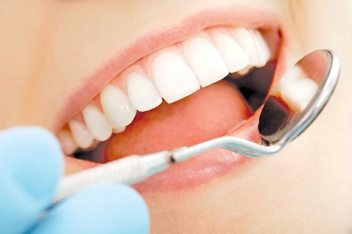 Dịch vụ bọc răng sứ zirconia có những ưu điểm nổi bật gì?-3
