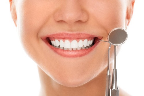 Niềng răng mắc cài sứ dây trong có ưu điểm gì? 3
