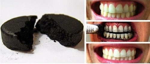Tẩy trắng răng bằng than hoạt tính hiệu quả ra sao? 2