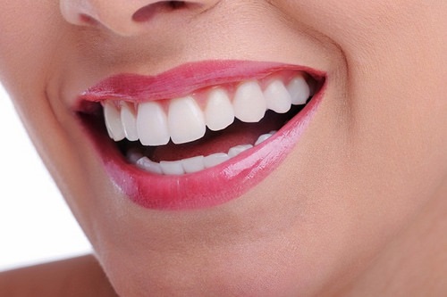 Có nên trồng răng sứ kim loại không? Lý do-4