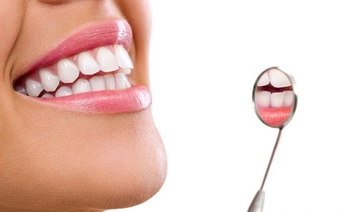 Răng sứ bị sâu có điều trị được không? Phải làm gì? 3