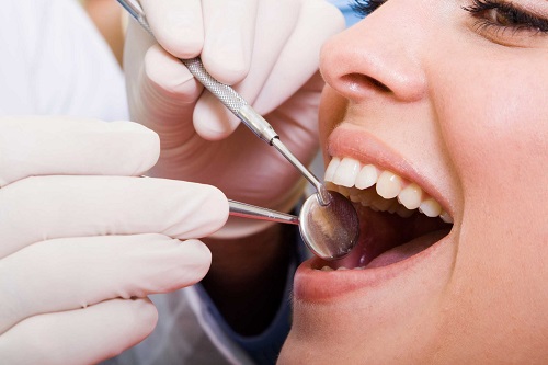 Trồng răng giả có lâu không? Phụ thuộc vào yếu tố nào? 4