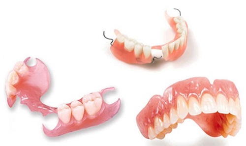Trồng răng giả hàm dưới - Phương pháp phục hình hiệu quả 2