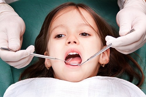 Khám răng cho bé ở đâu tốt và uy tín? 1
